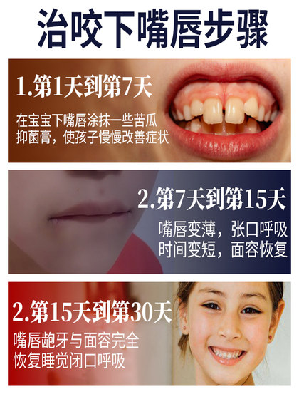 안티 바이트 하단 입술 인공물 아동 교정 장치 아기 입을 숨 쉬는 어린이의 볼록 입을 핥는 손가락 쓴 멜론 물을 방지합니다. 안티 바이트 하단 입술 인공물 아동 교정 장치 아기 입을 숨 쉬는 어린이의 볼록 입을 핥는 손가락 쓴 멜론 물을 방지합니다.
