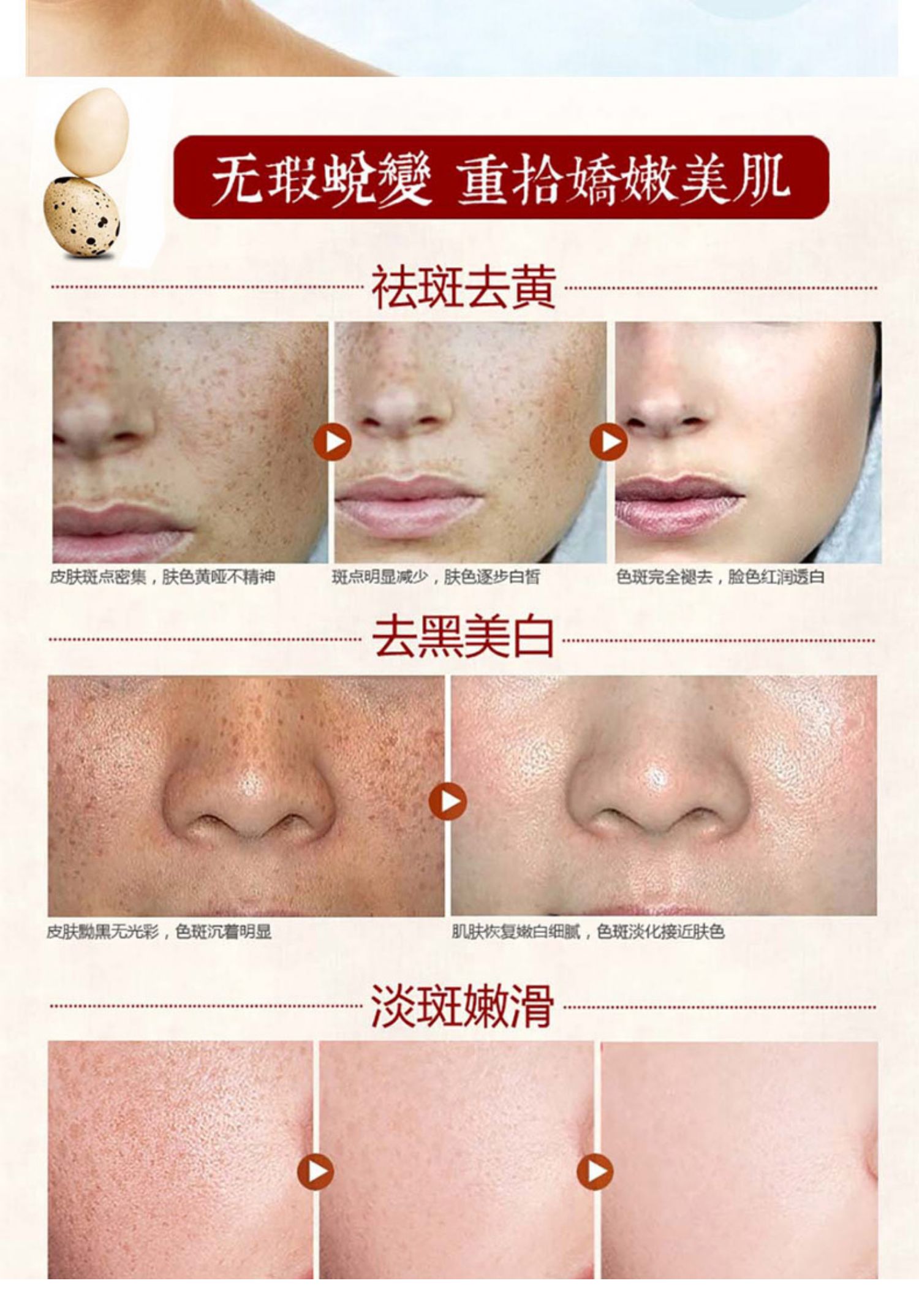正品去斑祛黄褐斑雀斑遗传斑老年斑晒斑祛斑霜产品面美白淡斑神器_54