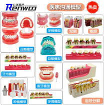 Dental model dental model dental standard dental model dental model dentures neurodoctor-patient communication