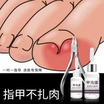 Toenail groove manicure scissors Yan clip groove set tool to long meat embedded nail pliers Pedicure special non-artifact