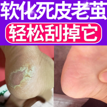 Dermabrasion scrape the soles of the feet dead skin footsteps old skin pedicure rub the calluses on the knife grindstone crusty skin not the skin of the feet not the artifact