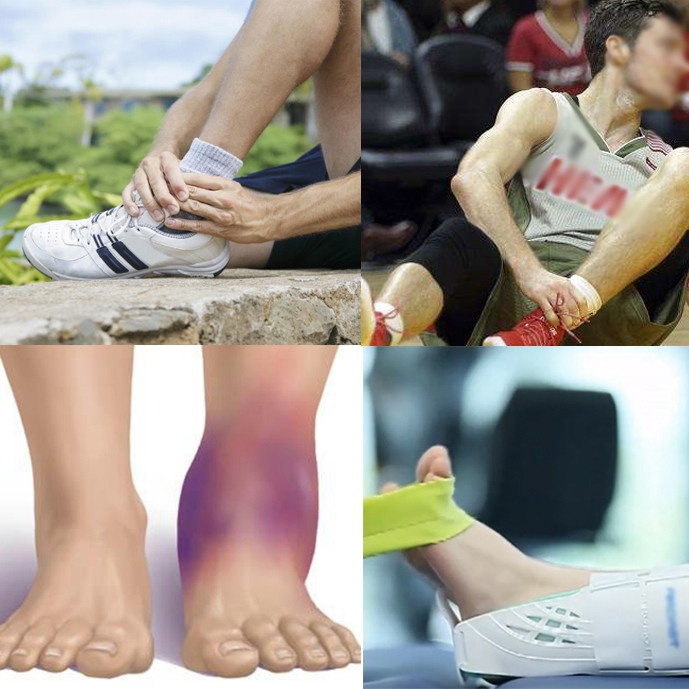 脚踝康复训练弹力带扭伤崴脚脚后跟腱骨折术后抗阻力锻炼韧带强化