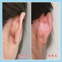 Elf ear sticker veneer ear stand ear sticker correction stereotype change wind ear artifact ear support sticker fixed ear sticker
