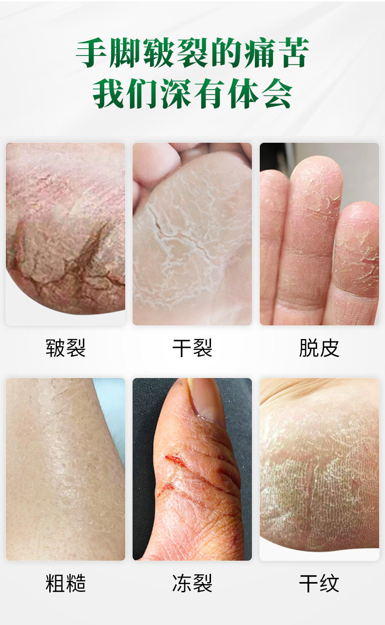 科婷手足皲裂修复护脚霜防脚裂膏脚后跟干裂龟裂开裂