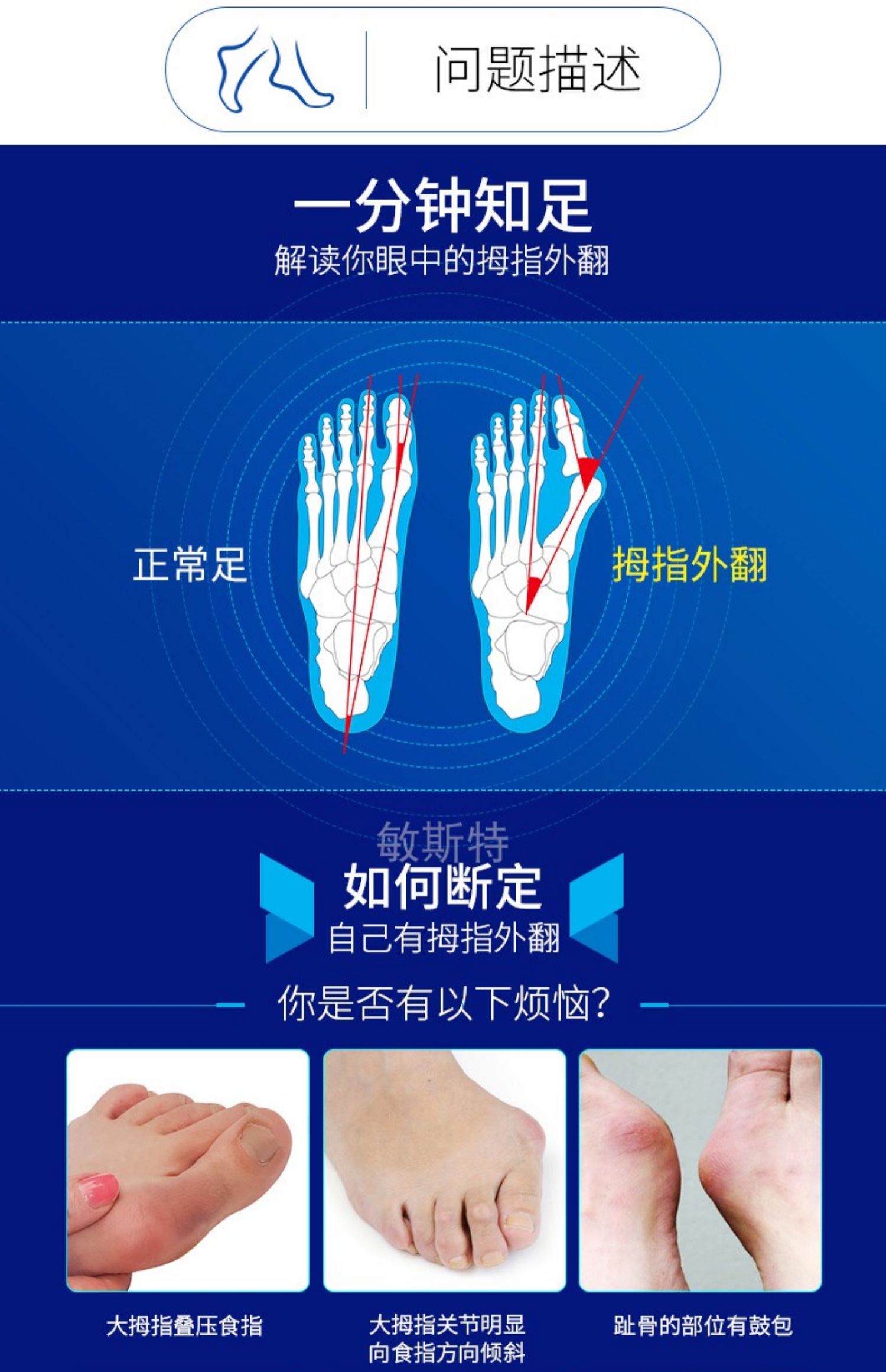 敏斯特大拇指外翻脚趾矫正器