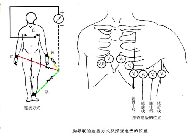 导联位置示意图图片