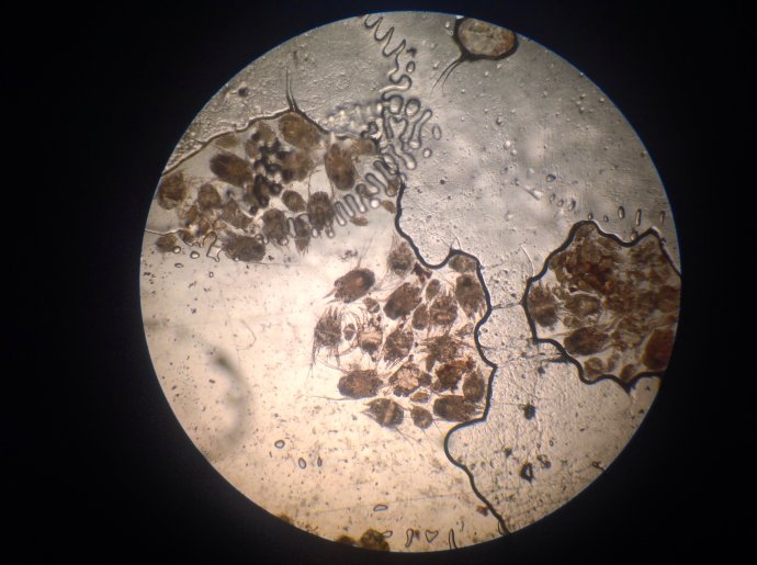 百灭宁 5% permethrin 疥螨疥虫100g/支毛囊螨扑灭司林