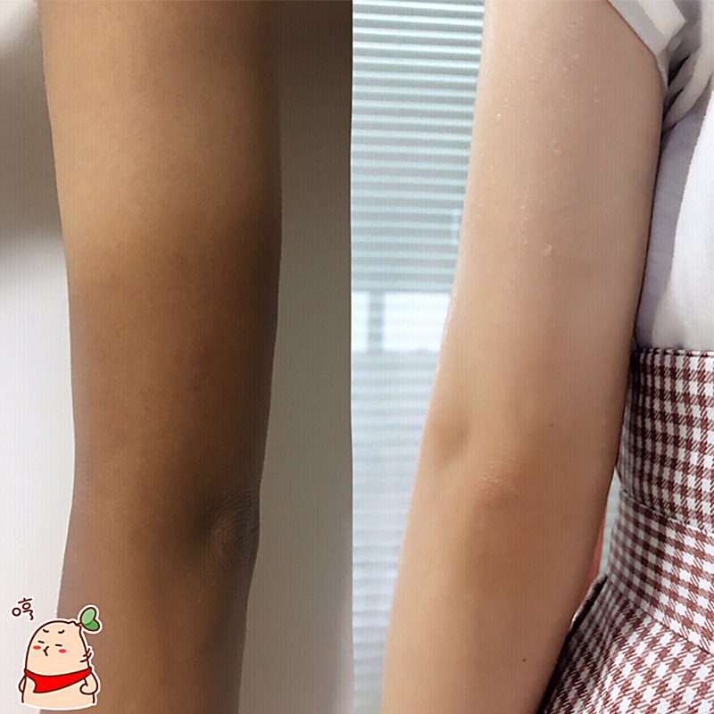 胳膊腋下黑脖子臀部手肘关节膝盖去黑色素沉淀全身神器按摩膏男女