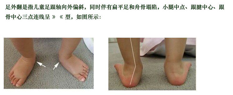 儿童丹尼矫形鞋夜用踝足康复器马蹄足内外翻矫正鞋脚踝固定支具