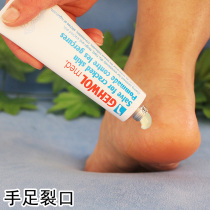 German Jievo heel crack dry crack repair foot cream Heel chapped foot dry artifact Anti-peeling crack cream