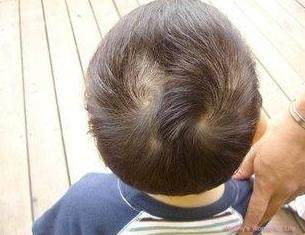 二胎性别看老大头旋,顺旋就换了,倒旋就一样.