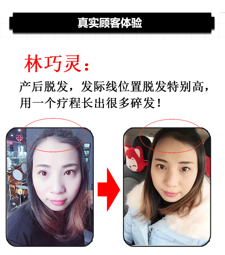 【无效我吃掉】 头发3-5倍自然生长速度