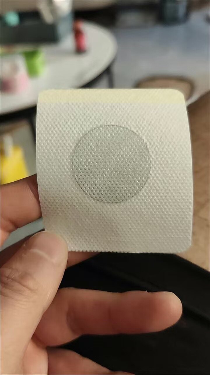 脂肪瘤一贴灵专消皮下肿块硬块单发性多发性脂肪瘤去粉瘤囊肿