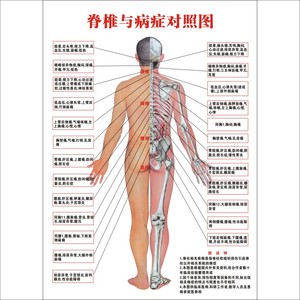 骨科美容院养生管医学挂图《脊椎与病症对照图