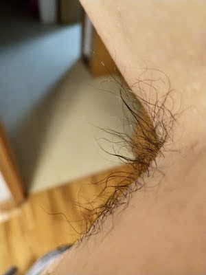 真实使用感受用后点评Ulike Aurora脱毛仪怎么样，是否真的有那么好用呢？