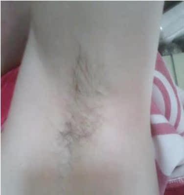 第一时间来确认收货，打开产品味道不刺鼻，很温和，人生中的第一次脱毛体验超干净，超方便，等待十分钟左右，先有纸巾擦拭腋下涂了脱毛膏的地方，然后用水冲洗了得了，一会儿再用舒缓水没什么刺激的感觉，坚持用一段时间，感觉毛毛变得细了很多，效果很不错，比我以前用过别的不怎么好闻的满意，脱毛很干净。