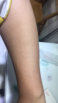 已经购买了很多次了，效果很好，一直都在坚持用他们家的脱毛膏，用了那么多终于又被抑制住了看，一开始用第一瓶的时候，觉得没什么效果，后来才知道是因为才用不可能一下子就没有的，要按疗程慢慢来，想着也不贵，就继续用了下去，毛毛慢慢有了改善，长得慢了也变得额细软了，一些毛毛已经都不长了，感觉绝毛的很有效果，推进好评 &nbsp;