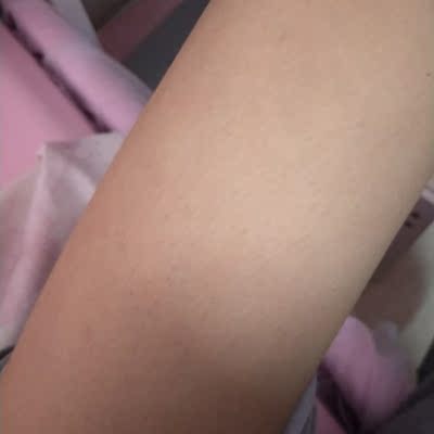 真实使用感受一知半解可思美日本IPL脉冲激光脱毛仪怎么样，好不好用？