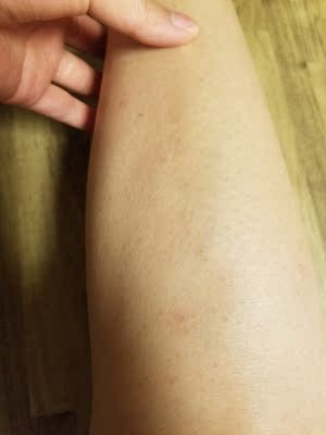 调查心得目前很火的歌岚脱毛仪怎么样,脱毛效果到底好不好?给力