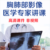 Chest Lung Radiography Learning Courted Piece Chest Image Reading lung Image Diagnosis Chest Sheet Reading