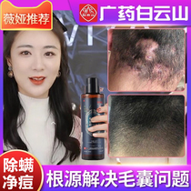 Baiyun Mountain head fur bursitis shampoo anti-dandruff anti-itching anti-mite oil control anti-removal mens cleaning scalp moss special