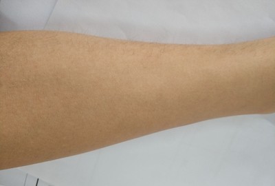 火爆的女友想种草silk’n丝可silkn Jewel光子脱毛仪，到底这个怎么样