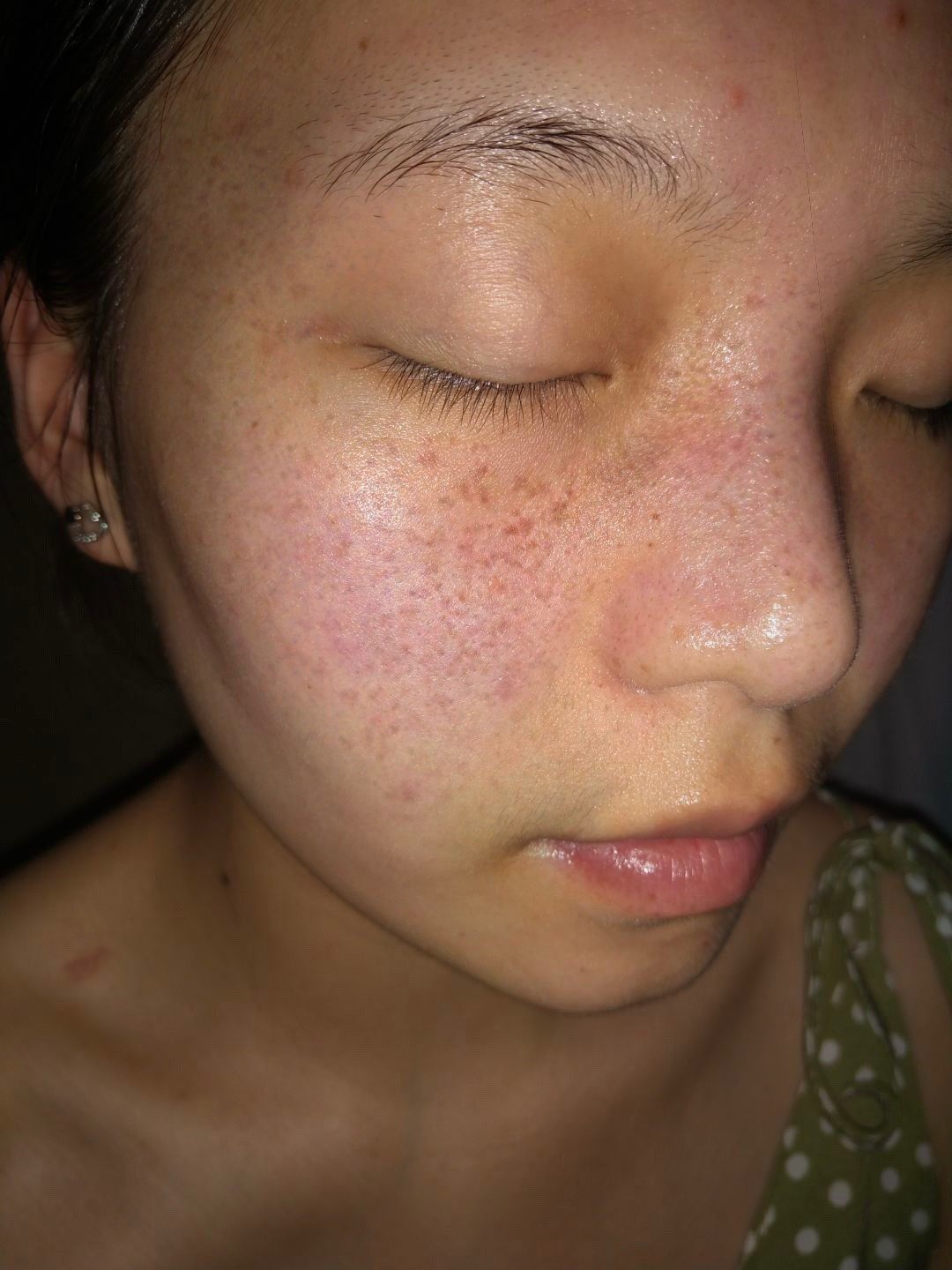 进口祛斑霜美白淡化色斑去斑祛黄褐斑雀斑产品神器官方旗舰店正品