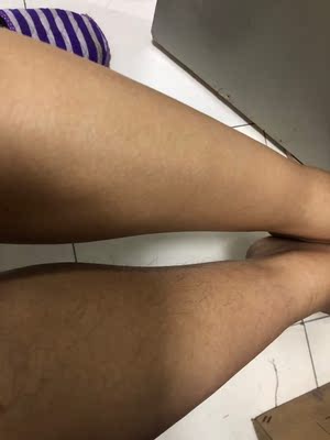 吐槽闺蜜推荐的ulike蓝宝石脱毛仪怎么样,是否真的那么好用神奇