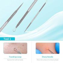 Blackhead Remover Xpreen Pimple Extractor Comedone Popper T