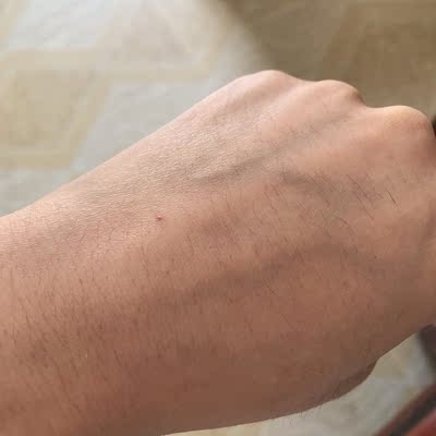 说说眼花缭乱的Ulike脱毛仪Diamond和Aurora哪款好用，该选哪一个？