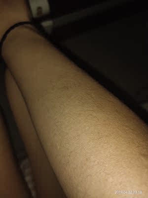 说说真相解说瑞宜激光脱毛仪怎么样，老司机评测是否好用？