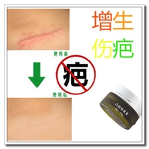 The ointment for repairing facial melanin removes burns and scars.