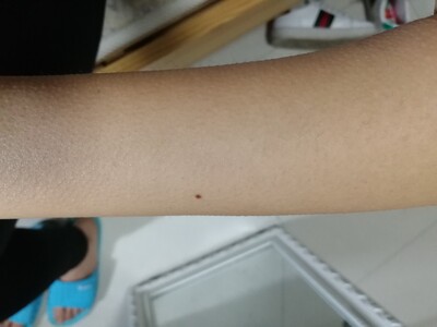 真实使用感受仙女爆料飞利浦脉冲光脱毛仪BRI956/SC1999质量怎么样？好用吗