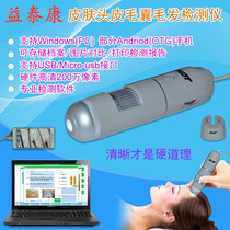 High-definition scalp tester Scalp hair follicle hair detector Hair magnifying glass Scalp care instrument Nail measurement