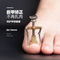 Positive nail buckle device peripheral nail foot groove inflammation orthosis nail tie correction device toe ring clamp