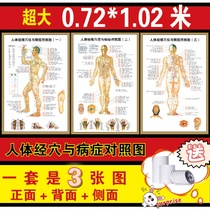 Chinese medicine acupoint map acupuncture meridian whole body massage home human meridian points and disease control wall chart pedicure scraping