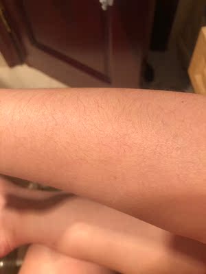 点评绝不偏颇的对比可思美和ulike哪个好，到底哪款真正好用？