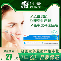 Tongnuo isotretinoin erythromycin Gel 10g * 1 box E-Vitamin v α micro-a acid ointment to close the mouth of the chicken skin pericortal keratinous acne pityriasis rosea removal cyst purulent acne