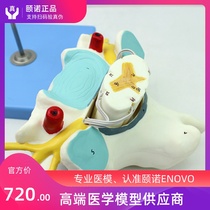 ENOVO Yinuo Medical Human Cervical Spinal Cord and Spinal Nerve Magnification Model Neuroorthopedic Anatomical Model