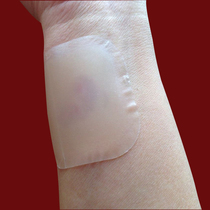 Self-adhesive breathable hydrocolloid dressing Bath swimming wound waterproof dressing Skin-friendly burns Pressure sores bedsore stickers