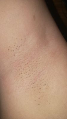 评测点评非常体验Silkpro激光脱毛仪怎么样，用后网友诉说真相，揭秘