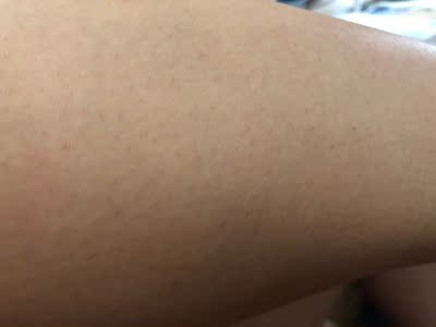 买到现在大约也用了五六天，给手臂做过两次，大约是三天一次，长得挺慢的，到现在为止也只长了两厘米，小腿上的会长得快一点，之前也是种草很久，因为看到评价说机器特别慢，根本没有耐心做下去，一直也挺担心买来没时间用的，现在觉得还好啦，其实没有他们评价的那么慢，我一般没课的时候看电视剧的时候做没觉得不耐烦，还是可以坚持的，希望坚持下去有用，会给大家继续测评的，如果有效果会给小仙女们追加的。