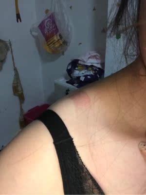 弄的这么紧还是滑肩，然后就是这个边搁着好痛，