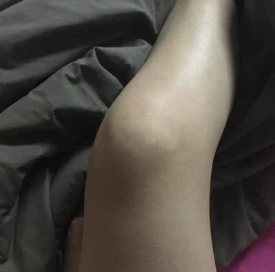 效果还不错，膝盖有变白点点