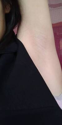 腋下的毛毛脱干净了，脱完像没有长过一样，很棒，店主人超好，解释的非常仔细