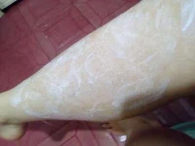 我的毛发比较浓密，用过之后很干净，而且很水润，皮肤都觉得润润的，挺好的，淡淡的柠檬清香 还有抑毛液，使用了一段时间毛发生长变慢了很多，太神奇了，用完之后最大的改善就是皮肤，感觉很湿润，皮肤摸上去滑滑的感觉！特别好！?使用后无过敏现象也没有刺痛感，是一款温和的产品。包装结实无破损，注意按照使用书去使用。放在皮肤上面觉得很温和 ，闻起来也没有刺鼻的味道，过程中也挺温和的， 脱后效果明显，看起来比原来的皮肤白了好多了。高端大气上档次，正品防伪，价格公道。下次还来！