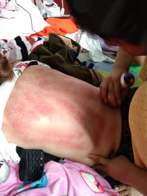 第二购买非常满意出沙快,第一次给自己买的第二次父母购买他们都说拔罐过后身体轻松,刮沙不通有点疼,通就不疼,效果看的见,加微信还减6.66元呢说实话哦 第二购买非常满意出沙快,第一次给自己买的第二次父母购买他们都说拔罐过后身体轻松,刮沙不通有点疼,通就不疼,效果看的见,加微信还减6.66元呢说实话哦