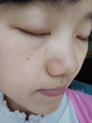 吐槽美悟黑头仪怎么样,美悟吸黑头神器好用不?真的有用吗?