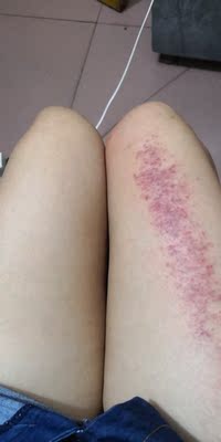 东西今天收到的，迫不及待用了，效果很好，可能是我不受力，感觉吸力好大啊，已经调到最小了吸的我还是痛，出了很多的痧气，做完了腿挺舒服，下次叫我老公给我做背，坚决支持，真的不错呢，价格也实惠，南极人的忠实拥护者，我可不是托