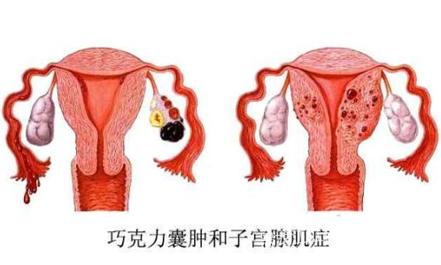 正常情况下,子宫内膜只在子宫内生长,且随月经的周期而规律出血.
